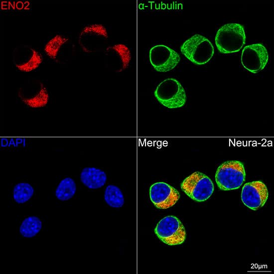 Immunocytochemistry/ Immunofluorescence: Enolase 2/Neuron-specific Enolase Antibody (9B4Y4) [Enolase 2/Neuron-specific Enolase] - Confocal imaging of Neuro-2a cells using Enolase 2/Neuron-specific Enolase Rabbit mAb . The cells were counterstained with alpha-Tubulin Mouse mAb  (Green). DAPI was used for nuclear staining (blue). Objective: 100x.