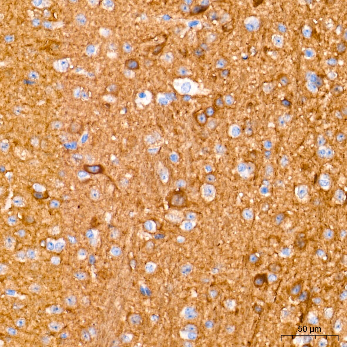 Immunohistochemistry: Enolase 2/Neuron-specific Enolase Antibody (9B4Y4) [Enolase 2/Neuron-specific Enolase] - Immunohistochemistry analysis of paraffin-embedded Mouse brain tissue using Enolase 2/Neuron-specific Enolase Rabbit mAb  at a dilution of 1:2000 (40x lens). High pressure antigen retrieval performed with 0.01M Tris-EDTA Buffer (pH 9.0) prior to IHC staining.