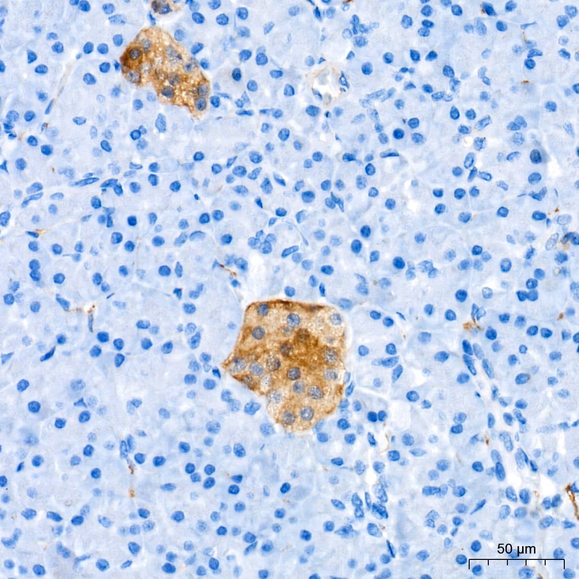 Immunohistochemistry: Enolase 2/Neuron-specific Enolase Antibody (9B4Y4) [Enolase 2/Neuron-specific Enolase] - Immunohistochemistry analysis of paraffin-embedded Human pancreas tissue using Enolase 2/Neuron-specific Enolase Rabbit mAb  at a dilution of 1:2000 (40x lens). High pressure antigen retrieval performed with 0.01M Tris-EDTA Buffer (pH 9.0) prior to IHC staining.