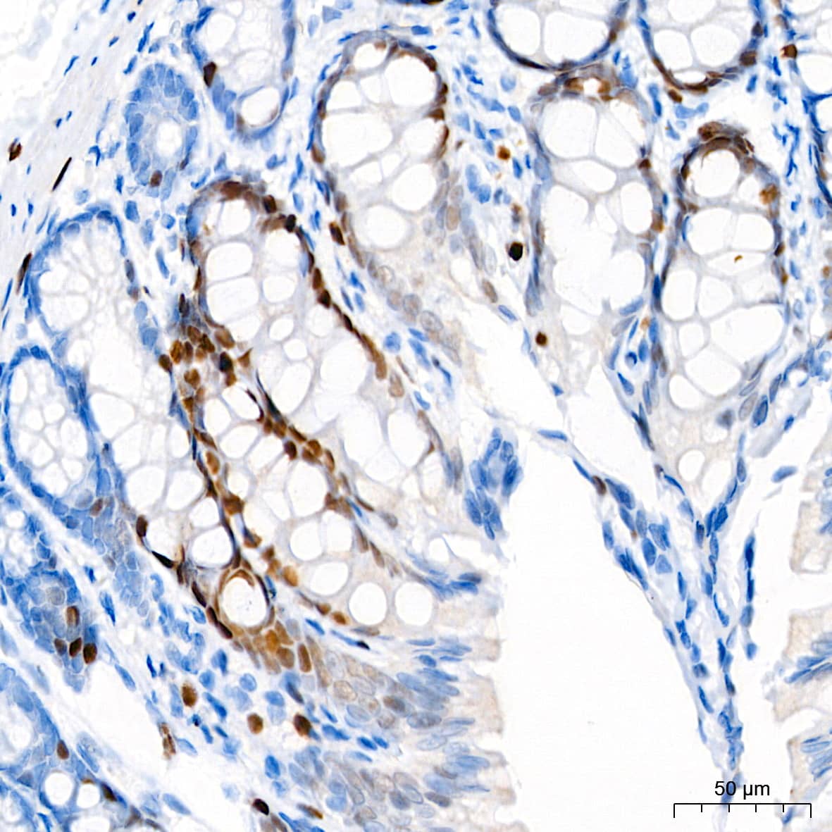 Immunohistochemistry: p21/CIP1/CDKN1A Antibody (4Z1H9) [p21/CIP1/CDKN1A] - Immunohistochemistry analysis of paraffin-embedded Rat colon tissue using [KO Validated] p21/CIP1/CDKN1A Rabbit mAb  at a dilution of 1:200 (40x lens). High pressure antigen retrieval performed with 0.01M Tris-EDTA Buffer(pH 9.0) prior to IHC staining.