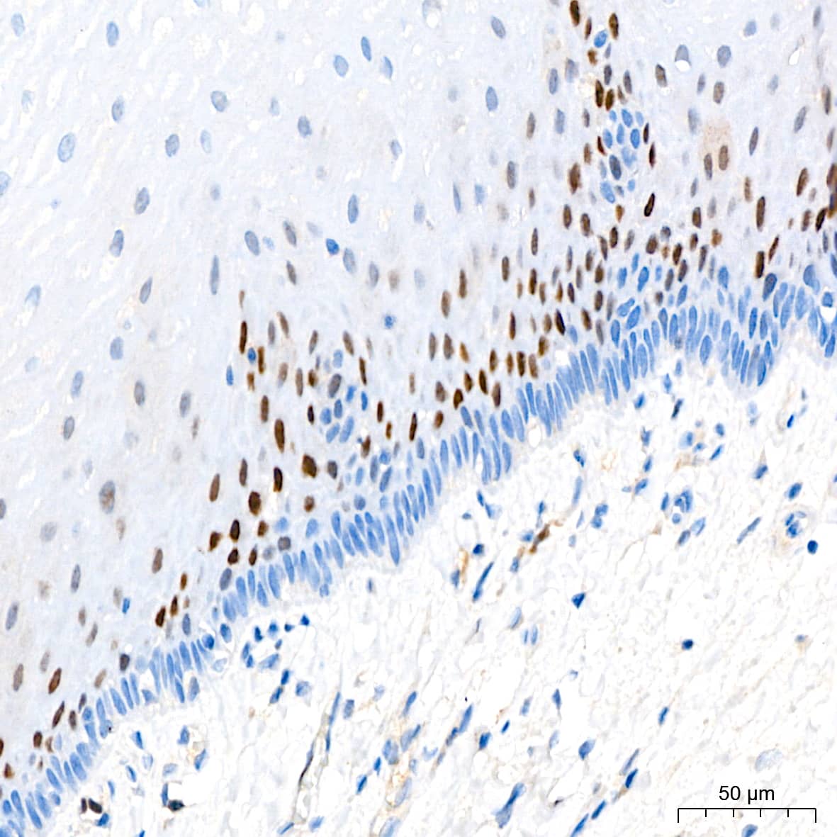 Immunohistochemistry: p21/CIP1/CDKN1A Antibody (4Z1H9) [p21/CIP1/CDKN1A] - Immunohistochemistry analysis of paraffin-embedded Human esophagus tissue using [KO Validated] p21/CIP1/CDKN1A Rabbit mAb  at a dilution of 1:200 (40x lens). High pressure antigen retrieval performed with 0.01M Tris-EDTA Buffer(pH 9.0) prior to IHC staining.