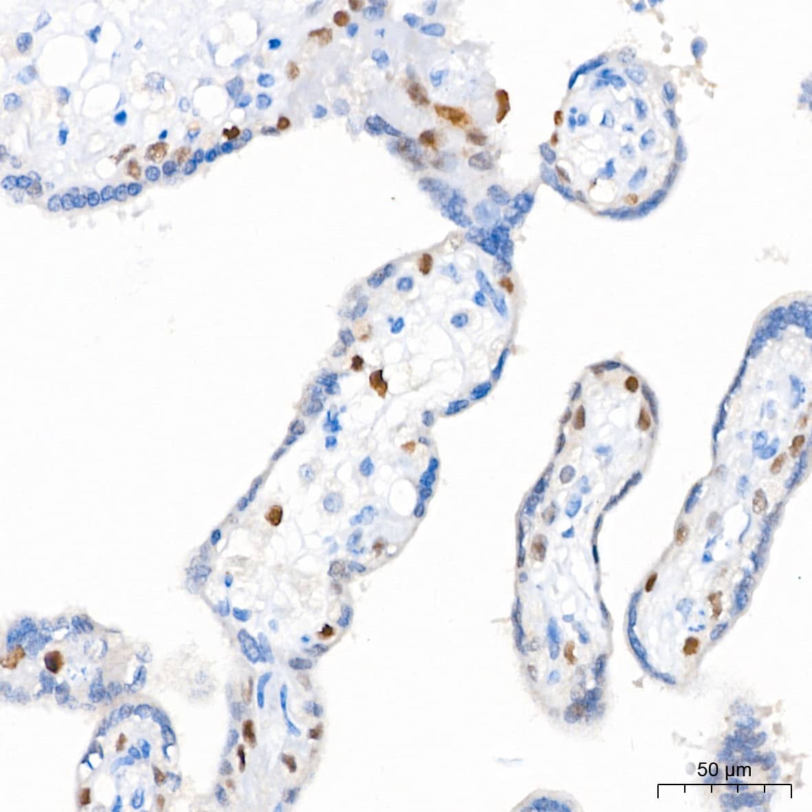 Immunohistochemistry: p21/CIP1/CDKN1A Antibody (4Z1H9) [p21/CIP1/CDKN1A] - Immunohistochemistry analysis of paraffin-embedded Human placenta tissue using [KO Validated] p21/CIP1/CDKN1A Rabbit mAb  at a dilution of 1:200 (40x lens). High pressure antigen retrieval performed with 0.01M Tris-EDTA Buffer(pH 9.0) prior to IHC staining.