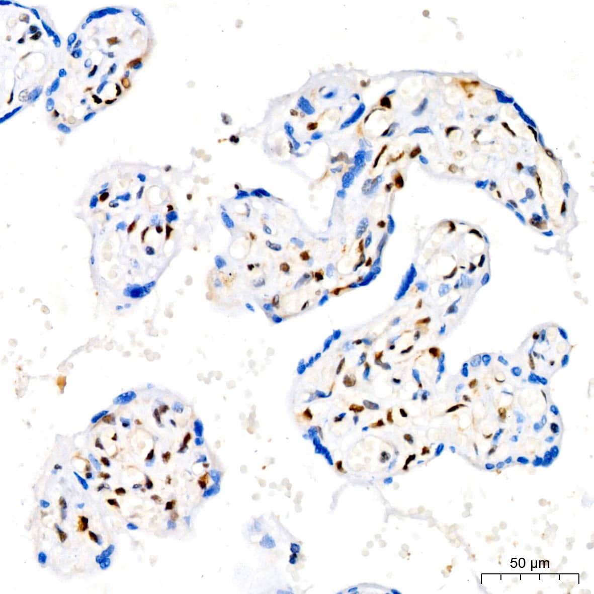 Immunohistochemistry: p27/Kip1 Antibody (9R5B4) [p27/Kip1] - Immunohistochemistry analysis of paraffin-embedded Human placenta tissue using p27/Kip1 Rabbit mAb  at a dilution of 1:200 (40x lens). High pressure antigen retrieval performed with 0.01M Citrate Buffer (pH 6.0) prior to IHC staining.