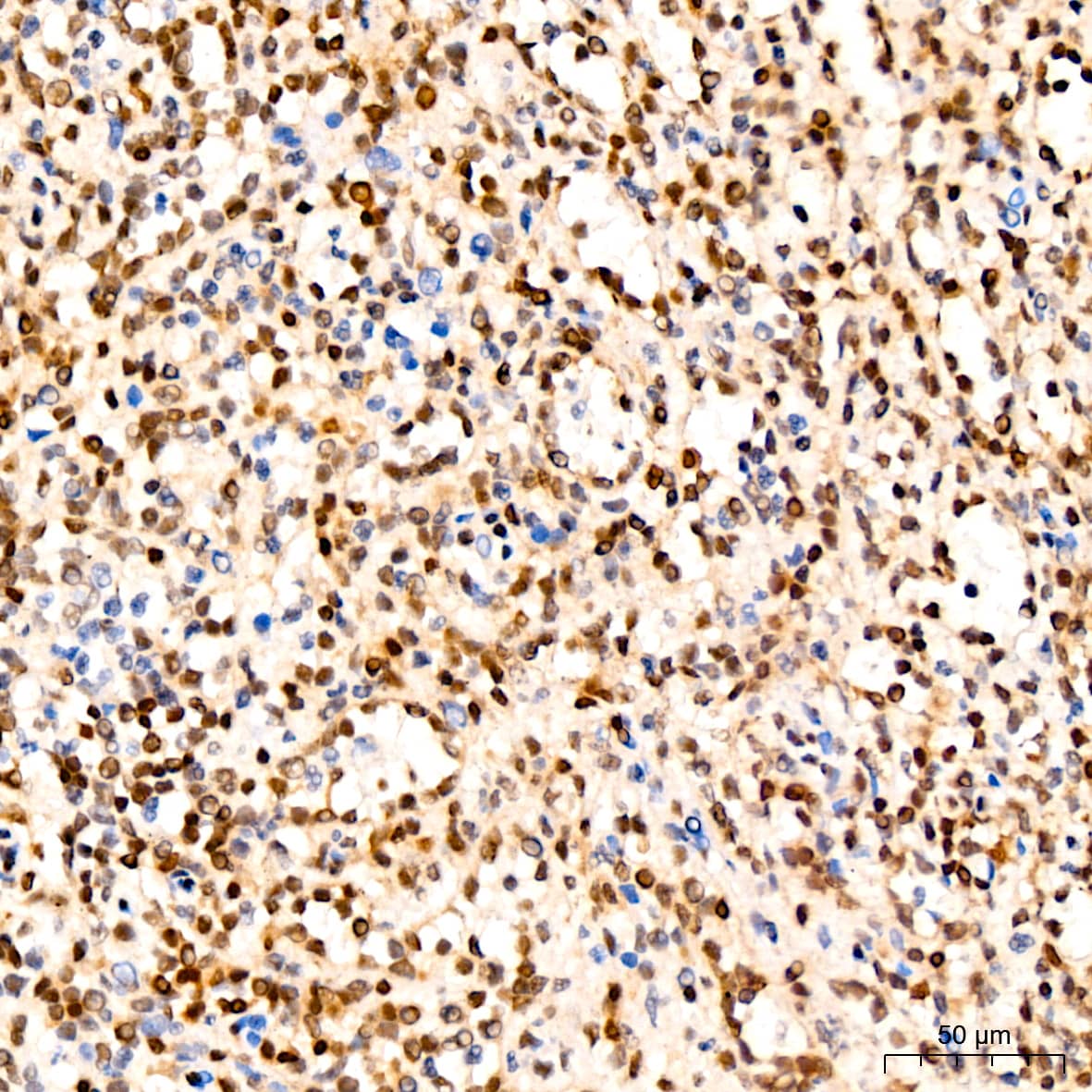 Immunohistochemistry: p27/Kip1 Antibody (9R5B4) [p27/Kip1] - Immunohistochemistry analysis of paraffin-embedded Human spleen tissue using p27/Kip1 Rabbit mAb  at a dilution of 1:200 (40x lens). High pressure antigen retrieval performed with 0.01M Citrate Buffer (pH 6.0) prior to IHC staining.