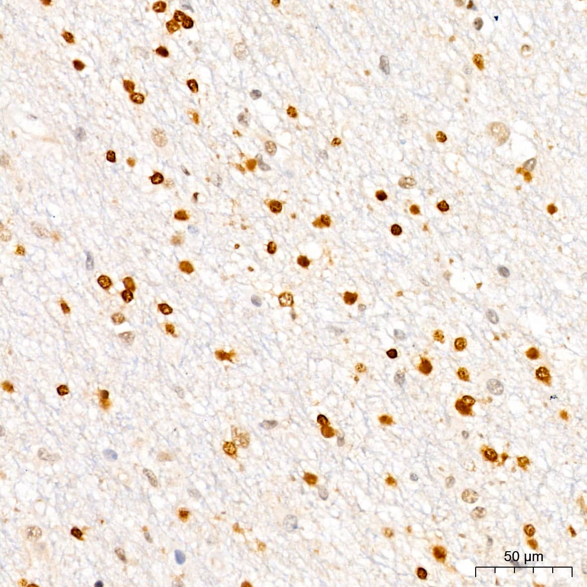 Immunohistochemistry: p27/Kip1 Antibody (9R5B4) [p27/Kip1] - Immunohistochemistry analysis of paraffin-embedded Human brain tissue using p27/Kip1 Rabbit mAb  at a dilution of 1:200 (40x lens). High pressure antigen retrieval performed with 0.01M Citrate Buffer (pH 6.0) prior to IHC staining.