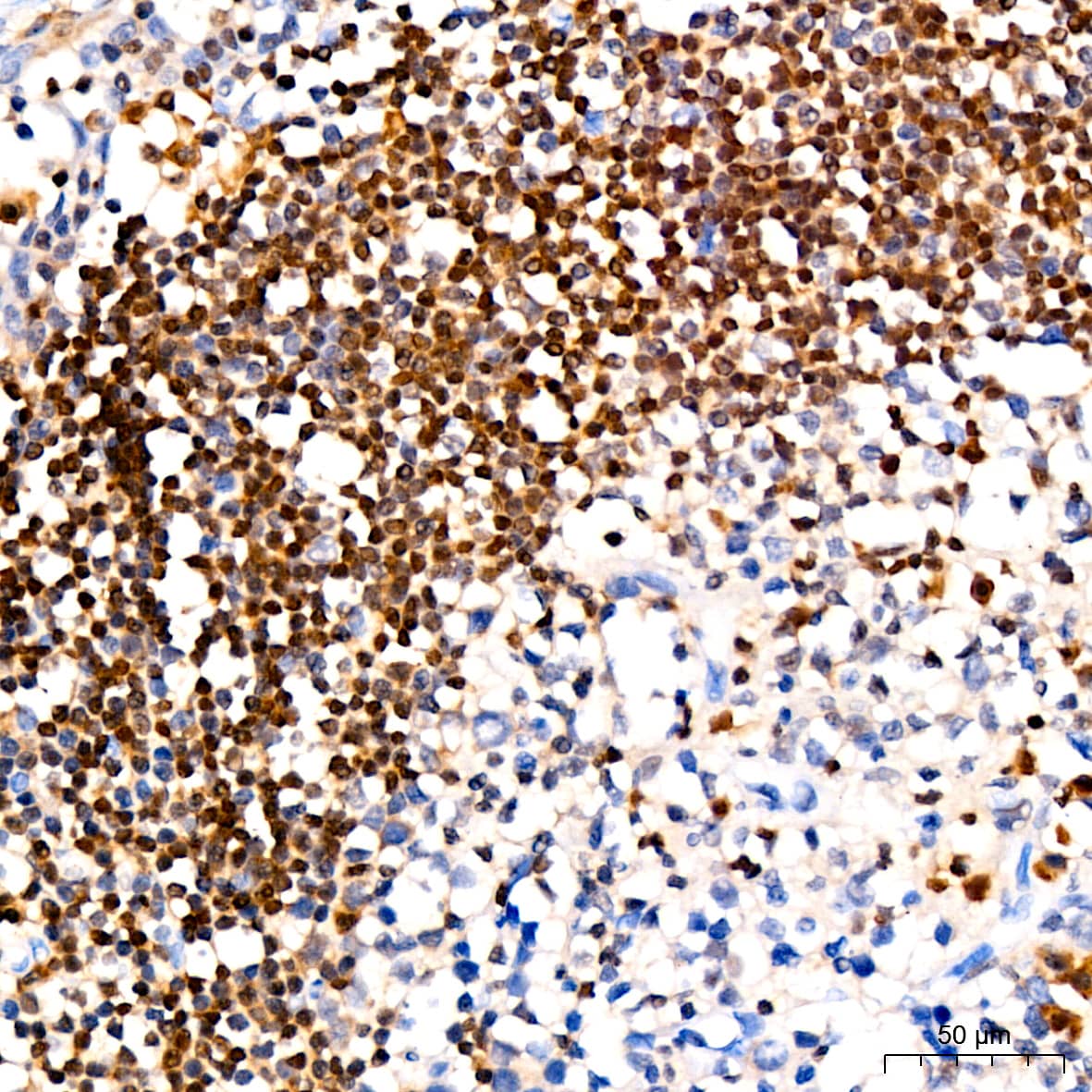 Immunohistochemistry: p27/Kip1 Antibody (9R5B4) [p27/Kip1] - Immunohistochemistry analysis of paraffin-embedded Human tonsil tissue using p27/Kip1 Rabbit mAb  at a dilution of 1:200 (40x lens). High pressure antigen retrieval performed with 0.01M Citrate Buffer (pH 6.0) prior to IHC staining.