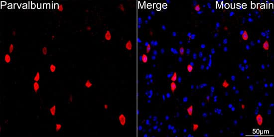 Immunocytochemistry/ Immunofluorescence: Parvalbumin Antibody (6C7K6) [Parvalbumin] - Confocal imaging of paraffin-embedded Mouse brain tissue using Parvalbumin (PVALB) Rabbit mAb  followed by a further incubation with Cy3 Goat Anti-Rabbit IgG (H+L)  . DAPI was used for nuclear staining (Blue). Microwave antigen retrieval performed with 0.01M Citrate Buffer (pH 6.0) prior to IF staining. Objective: 40x.