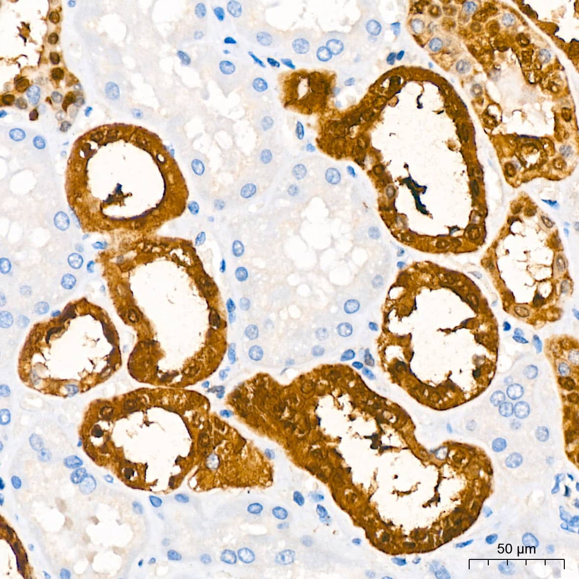 Immunohistochemistry: Parvalbumin Antibody (6C7K6) [Parvalbumin] - Immunohistochemistry analysis of paraffin-embedded Human kidney using Parvalbumin (PVALB) Rabbit mAb  at dilution of 1:200 (40x lens). High pressure antigen retrieval performed with 0.01M Citrate Bufferr (pH 6.0) prior to IHC staining.