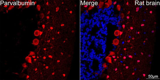 Immunocytochemistry/ Immunofluorescence: Parvalbumin Antibody (6C7K6) [Parvalbumin] - Confocal imaging of paraffin-embedded Rat brain tissue using Parvalbumin (PVALB) Rabbit mAb  followed by a further incubation with Cy3 Goat Anti-Rabbit IgG (H+L)  . DAPI was used for nuclear staining (Blue). Microwave antigen retrieval performed with 0.01M Citrate Buffer (pH 6.0) prior to IF staining. Objective: 40x.