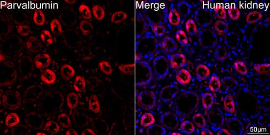 Immunocytochemistry/ Immunofluorescence: Parvalbumin Antibody (6C7K6) [Parvalbumin] - Confocal imaging of paraffin-embedded Human kidney tissue using Parvalbumin (PVALB) Rabbit mAb  followed by a further incubation with Cy3 Goat Anti-Rabbit IgG (H+L)  . DAPI was used for nuclear staining (Blue). High pressure antigen retrieval performed with 0.01M Citrate Buffer (pH 6.0) prior to IF staining. Objective: 40x.