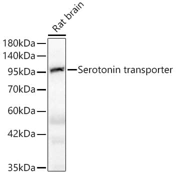 Western Blot: SLC6A4/5-HTTLPR/Serotonin transporter Antibody (5T7M2) [SLC6A4/5-HTTLPR/Serotonin transporter] - Western blot analysis of rat brain using SLC6A4/5-HTTLPR/Serotonin transporter Rabbit mAb  at  1:1000 dilution.Secondary antibody: HRP Goat Anti-Rabbit IgG (H+L)  at 1:10000 dilution.Lysates/proteins: 25ug per lane.Blocking buffer: 3% nonfat dry milk in TBST.Detection: ECL Basic Kit .Exposure time: 5s.