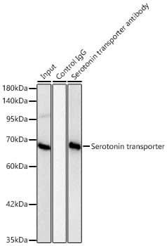 Immunoprecipitation: SLC6A4/5-HTTLPR/Serotonin transporter Antibody (5T7M2) [SLC6A4/5-HTTLPR/Serotonin transporter] - Immunoprecipitation of SLC6A4/5-HTTLPR/Serotonin transporter from 500 ug extracts of HT-29 cells was performed using 2 ug of SLC6A4/5-HTTLPR/Serotonin transporter Rabbit mAb . Rabbit IgG isotype control  was used to precipitate the Control IgG sample. IP samples were eluted with 1X Laemmli Buffer. The Input lane represents 10% of the total input. Western blot analysis of immunoprecipitates was conducted using SLC6A4/5-HTTLPR/Serotonin transporter Rabbit mAb  at a dilution of 1:1000.