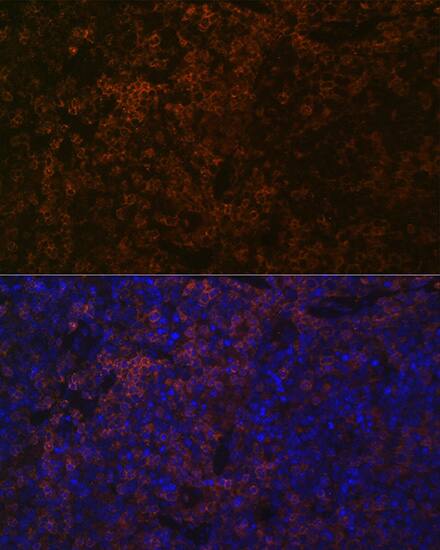 Immunocytochemistry/ Immunofluorescence: SHP-1 Antibody (7I1K3) [SHP-1] - Immunofluorescence analysis of paraffin-embedded mouse spleen using SHP-1 Rabbit mAb  at dilution of 1:100 (40x lens). Secondary antibody: Cy3-conjugated Goat anti-Rabbit IgG (H+L)  at 1:500 dilution. Blue: DAPI for nuclear staining.