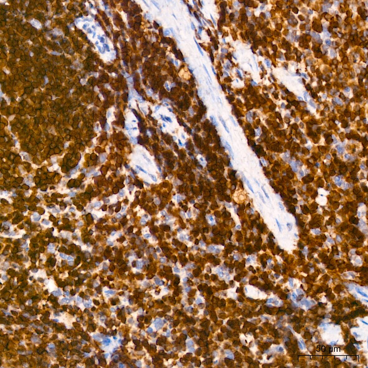 Immunohistochemistry: SHP-1 Antibody (7I1K3) [SHP-1] - Immunohistochemistry analysis of paraffin-embedded Mouse spleen tissue using SHP-1 Rabbit mAb  at a dilution of 1:800 (40x lens). High pressure antigen retrieval performed with 0.01M Citrate Bufferr (pH 6.0) prior to IHC staining.