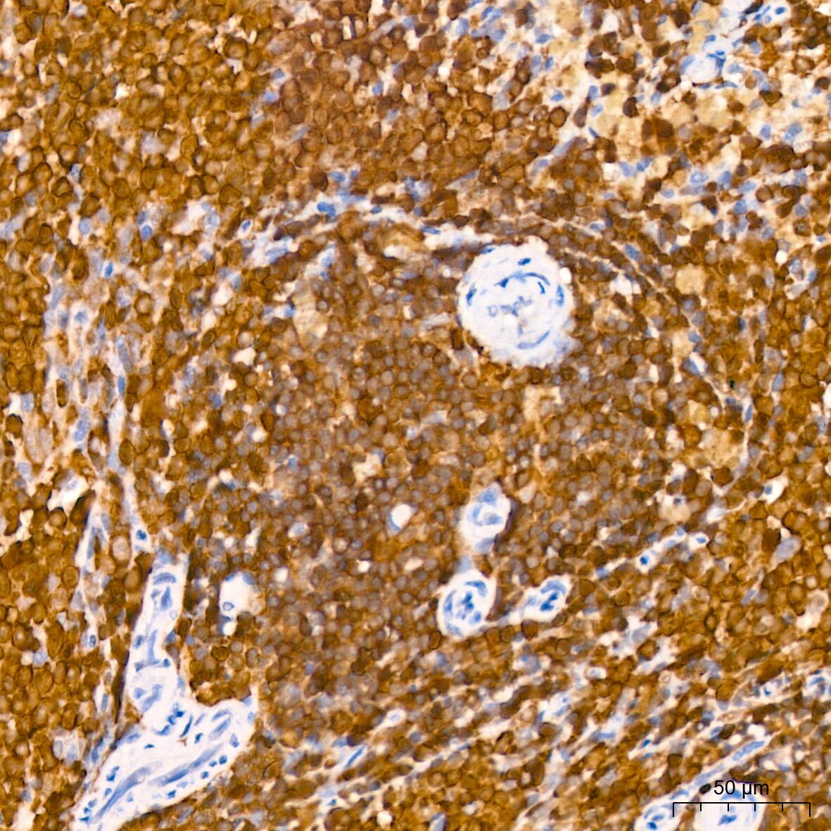 Immunohistochemistry: SHP-1 Antibody (7I1K3) [SHP-1] - Immunohistochemistry analysis of paraffin-embedded Rat spleen tissue using SHP-1 Rabbit mAb  at a dilution of 1:800 (40x lens). High pressure antigen retrieval performed with 0.01M Citrate Bufferr (pH 6.0) prior to IHC staining.