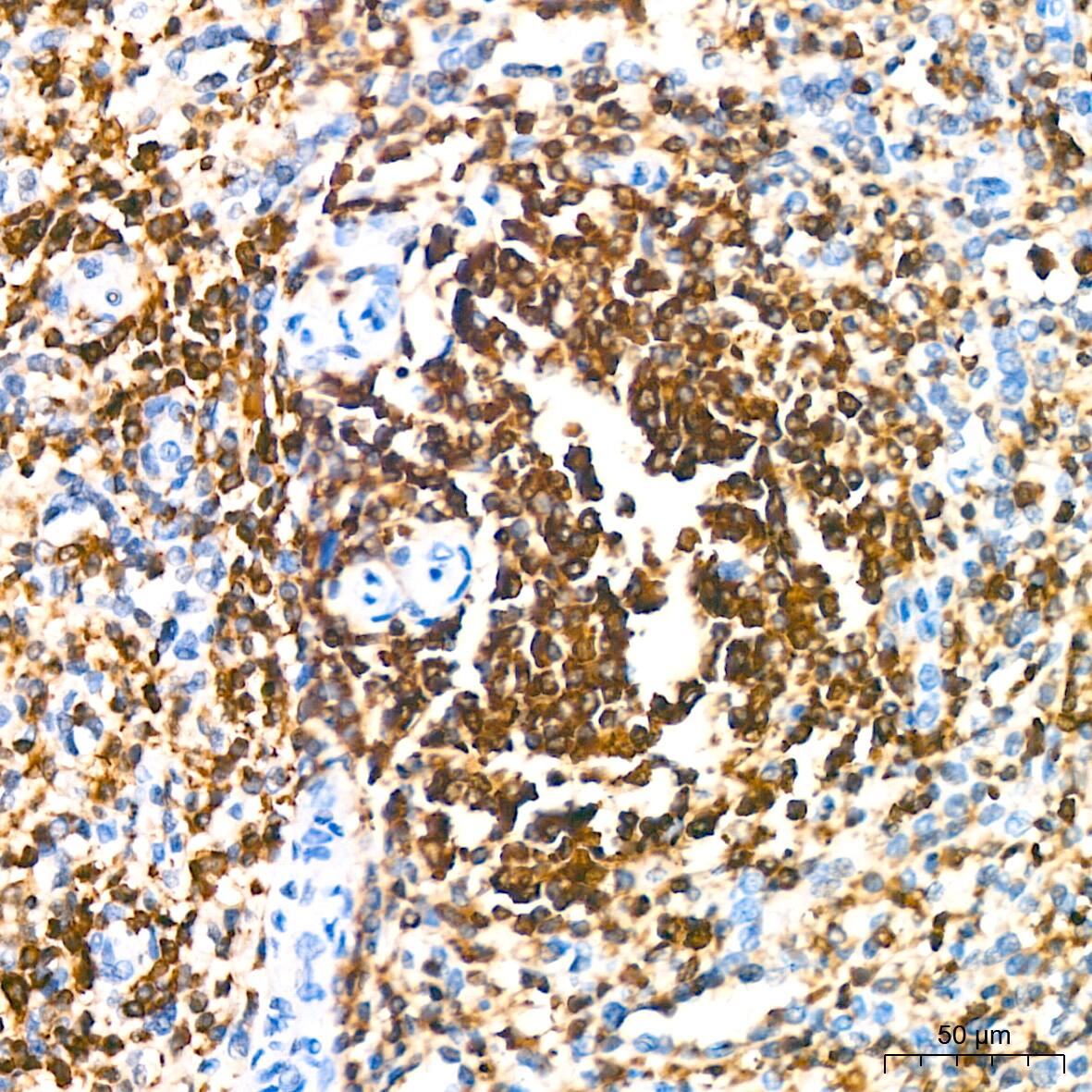 Immunohistochemistry: SHP-1 Antibody (7I1K3) [SHP-1] - Immunohistochemistry analysis of paraffin-embedded Human spleen tissue using SHP-1 Rabbit mAb  at a dilution of 1:200 (40x lens). High pressure antigen retrieval performed with 0.01M Citrate Bufferr (pH 6.0) prior to IHC staining.