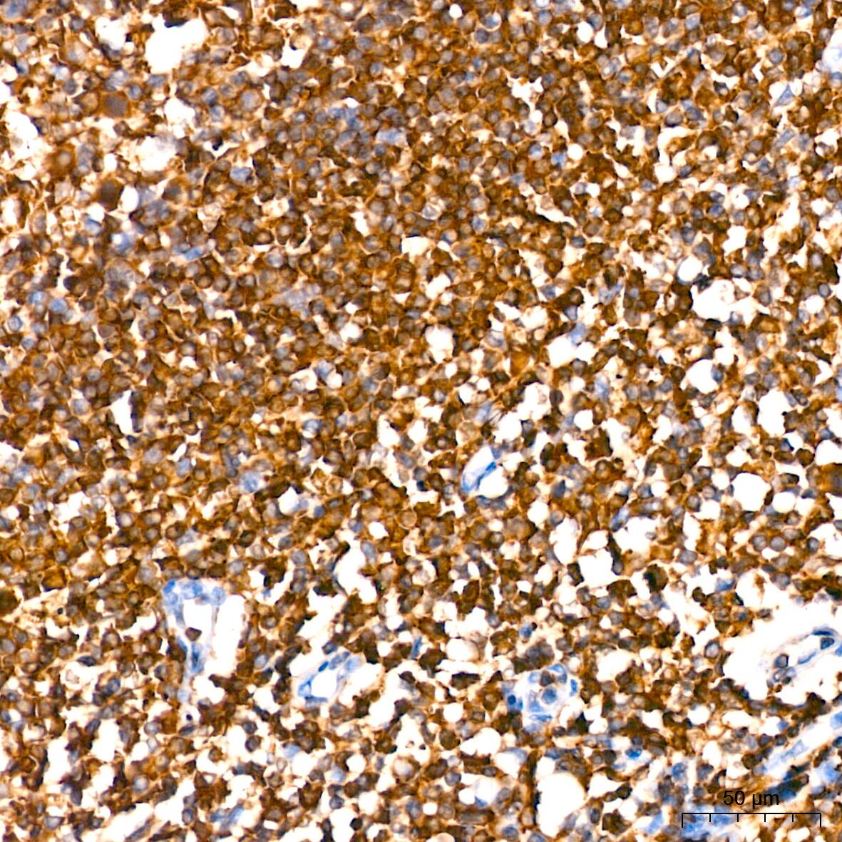 Immunohistochemistry: SHP-1 Antibody (7I1K3) [SHP-1] - Immunohistochemistry analysis of paraffin-embedded Human tonsil tissue using SHP-1 Rabbit mAb  at a dilution of 1:200 (40x lens). High pressure antigen retrieval performed with 0.01M Citrate Bufferr (pH 6.0) prior to IHC staining.