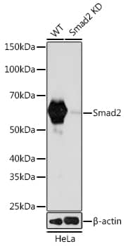 <b>Genetic Strategies Validation. </b>Western Blot: Smad2 Antibody (2E3D8) [Smad2] - Western blot analysis of lysates from wild type (WT) and Smad2 knockdown (KD) HeLa cells using [KD Validated] Smad2 Rabbit mAb  at 1:1000 dilution incubated overnight at 4C.Secondary antibody: HRP-conjugated Goat anti-Rabbit IgG (H+L)  at 1:10000 dilution.Lysates/proteins: 25ug per lane.Blocking buffer: 3% nonfat dry milk in TBST.Detection: ECL Basic Kit .Exposure time: 60s.