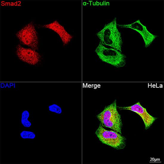 Immunocytochemistry/ Immunofluorescence: Smad2 Antibody (2E3D8) [Smad2] - Confocal imaging of HeLa cells using [KD Validated] Smad2 Rabbit mAb  followed by a further incubation with Cy3 Goat Anti-Rabbit IgG (H+L)  . The cells were counterstained with alpha-Tubulin Mouse mAb  followed by incubation with ABflo 488-conjugated Goat Anti-Mouse IgG (H+L) Ab  (Green). DAPI was used for nuclear staining (Blue). Objective: 100x.