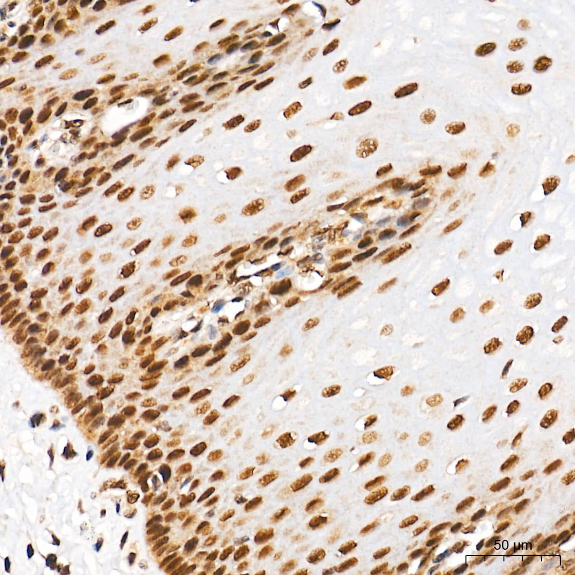 Immunohistochemistry: SUMO1 Antibody (6F8B6) [SUMO1] - Immunohistochemistry analysis of paraffin-embedded Human esophagus tissue using [KO Validated] SUMO1 Rabbit mAb  at a dilution of 1:5000 (40x lens). High pressure antigen retrieval performed with 0.01M Tris-EDTA Buffer (pH 9.0) prior to IHC staining.