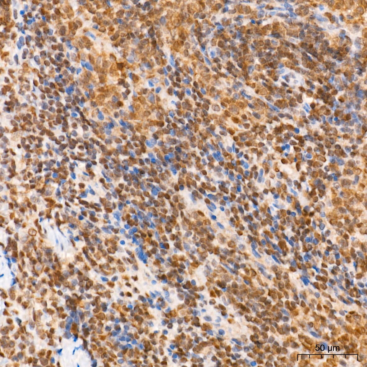 Immunohistochemistry: SUMO1 Antibody (6F8B6) [SUMO1] - Immunohistochemistry analysis of paraffin-embedded Rat spleen tissue using [KO Validated] SUMO1 Rabbit mAb  at a dilution of 1:5000 (40x lens). High pressure antigen retrieval performed with 0.01M Tris-EDTA Buffer (pH 9.0) prior to IHC staining.