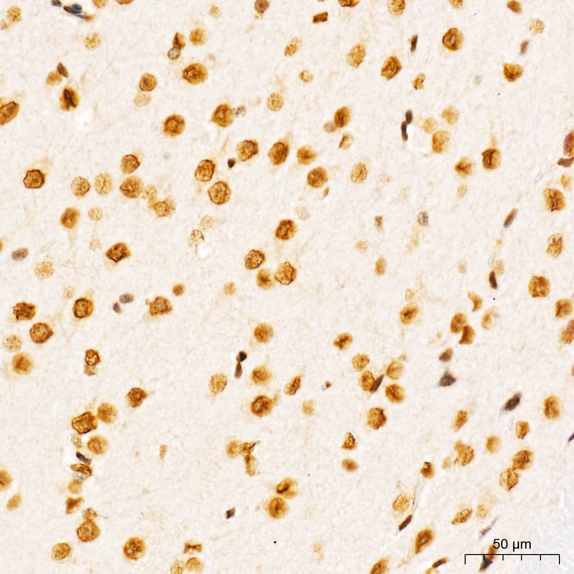 Immunohistochemistry: SUMO1 Antibody (6F8B6) [SUMO1] - Immunohistochemistry analysis of paraffin-embedded Mouse brain tissue using [KO Validated] SUMO1 Rabbit mAb  at a dilution of 1:5000 (40x lens). High pressure antigen retrieval performed with 0.01M Tris-EDTA Buffer (pH 9.0) prior to IHC staining.