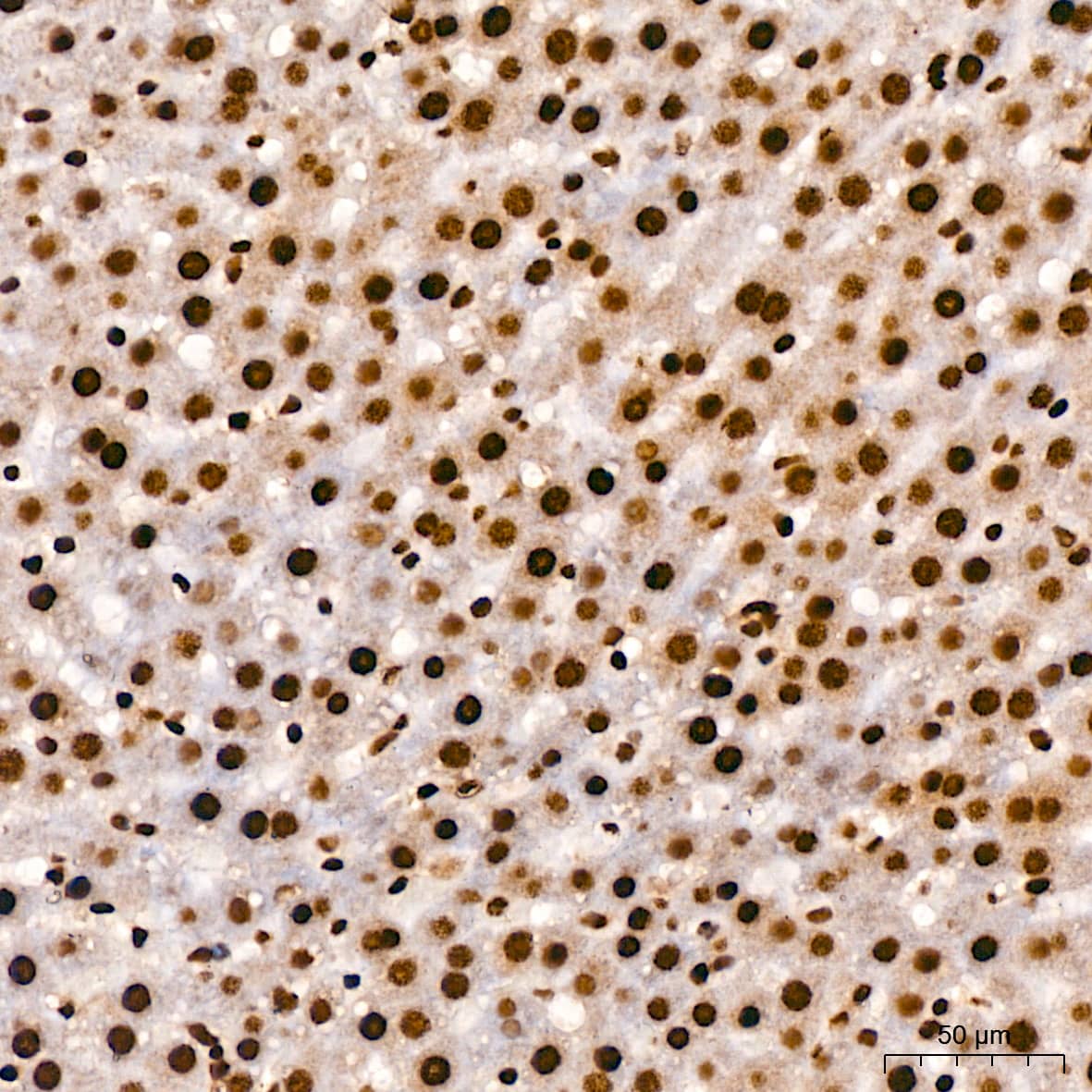 Immunohistochemistry: TDP-43/TARDBP Antibody (4R5L7) [TDP-43/TARDBP] - Immunohistochemistry analysis of paraffin-embedded Rat liver using TDP-43/TARDBP Rabbit mAb  at dilution of  1:200 (40x lens). High pressure antigen retrieval performed with 0.01M Citrate Bufferr (pH 6.0) prior to IHC staining.