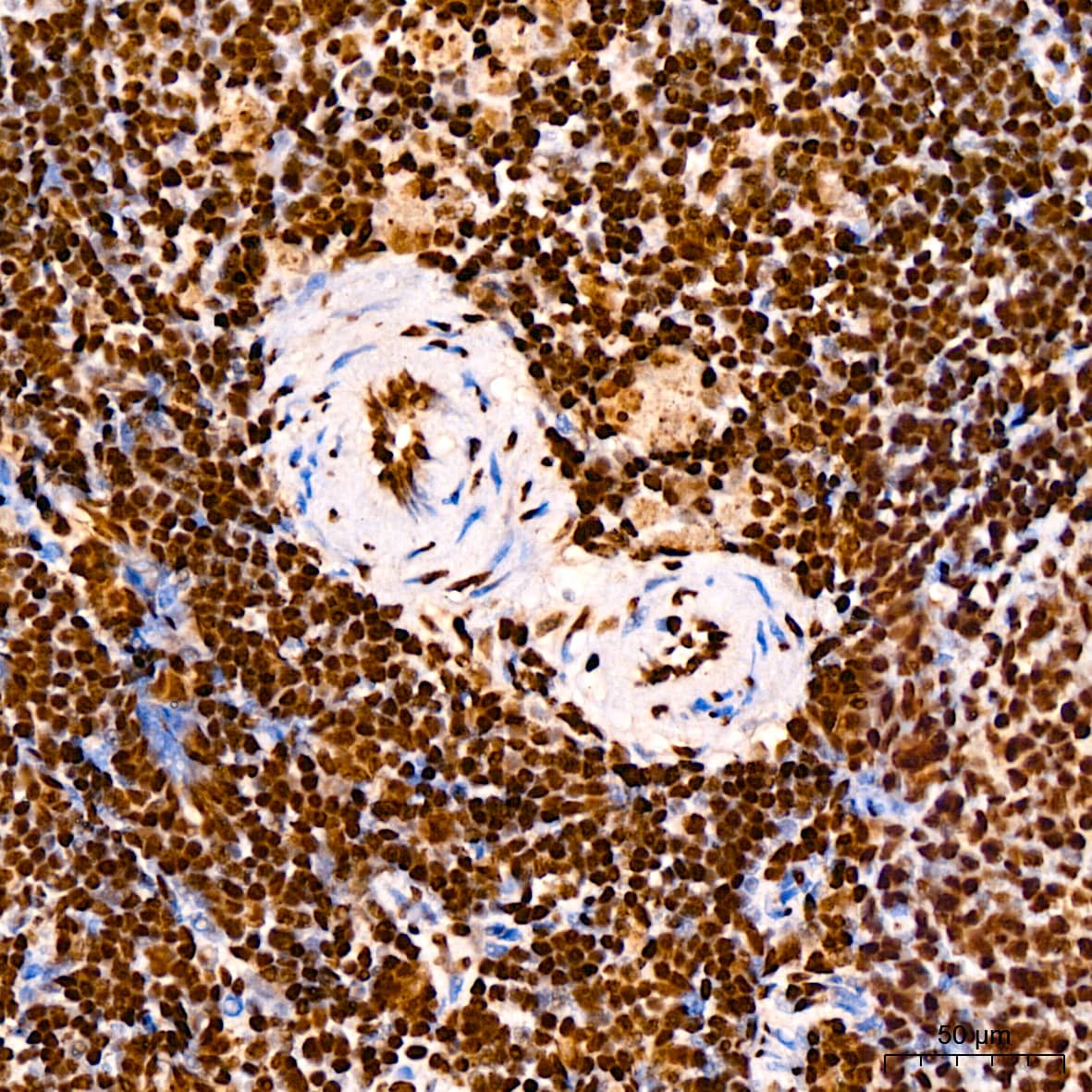 Immunohistochemistry: TDP-43/TARDBP Antibody (4R5L7) [TDP-43/TARDBP] - Immunohistochemistry analysis of paraffin-embedded Rat spleen using TDP-43/TARDBP Rabbit mAb  at dilution of  1:200 (40x lens). High pressure antigen retrieval performed with 0.01M Citrate Bufferr (pH 6.0) prior to IHC staining.