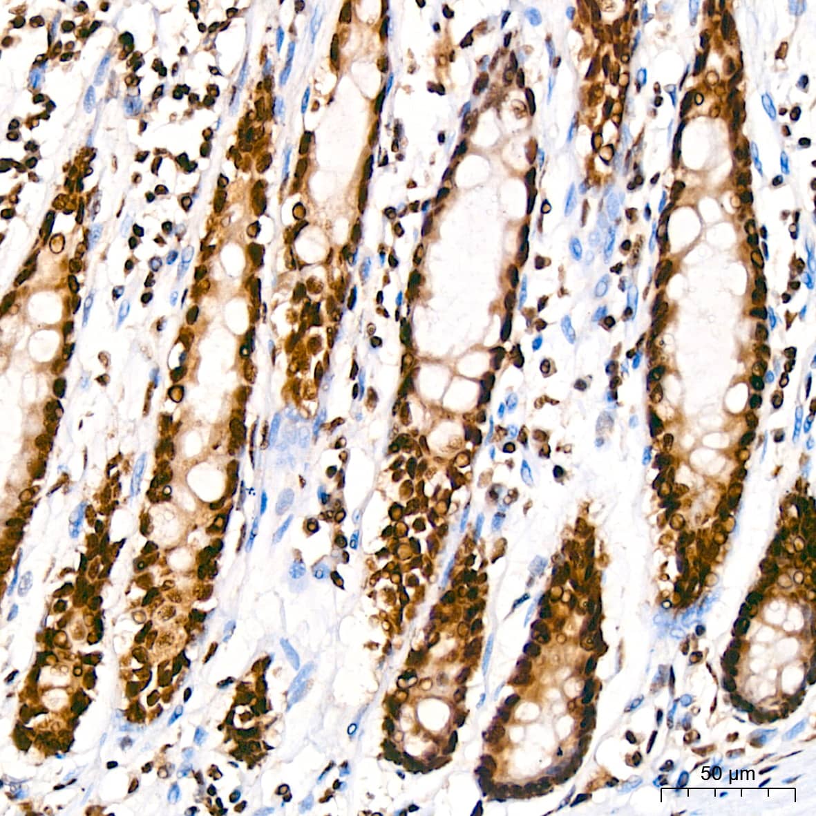 Immunohistochemistry: TDP-43/TARDBP Antibody (4R5L7) [TDP-43/TARDBP] - Immunohistochemistry analysis of paraffin-embedded Human colon using TDP-43/TARDBP Rabbit mAb  at dilution of  1:200 (40x lens). High pressure antigen retrieval performed with 0.01M Citrate Bufferr (pH 6.0) prior to IHC staining.