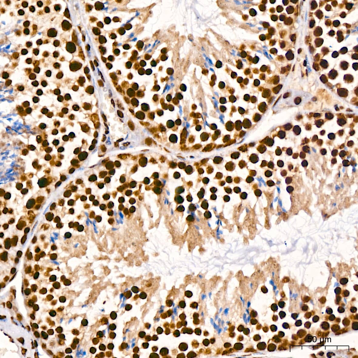 Immunohistochemistry: TDP-43/TARDBP Antibody (4R5L7) [TDP-43/TARDBP] - Immunohistochemistry analysis of paraffin-embedded Mouse testis using TDP-43/TARDBP Rabbit mAb  at dilution of  1:200 (40x lens). High pressure antigen retrieval performed with 0.01M Citrate Bufferr (pH 6.0) prior to IHC staining.