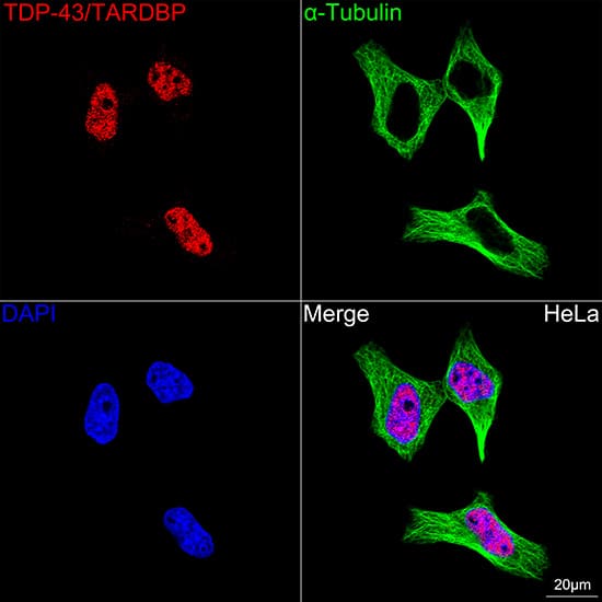 Immunocytochemistry/ Immunofluorescence: TDP-43/TARDBP Antibody (4R5L7) [TDP-43/TARDBP] - Confocal imaging of HeLa cells using TDP-43/TARDBP Rabbit mAb  followed by a further incubation with Cy3 Goat Anti-Rabbit IgG (H+L)  . The cells were counterstained with alpha-Tubulin Mouse mAb  followed by incubation with ABflo 488-conjugated Goat Anti-Mouse IgG (H+L) Ab  (Green). DAPI was used for nuclear staining (Blue). Objective: 100x.