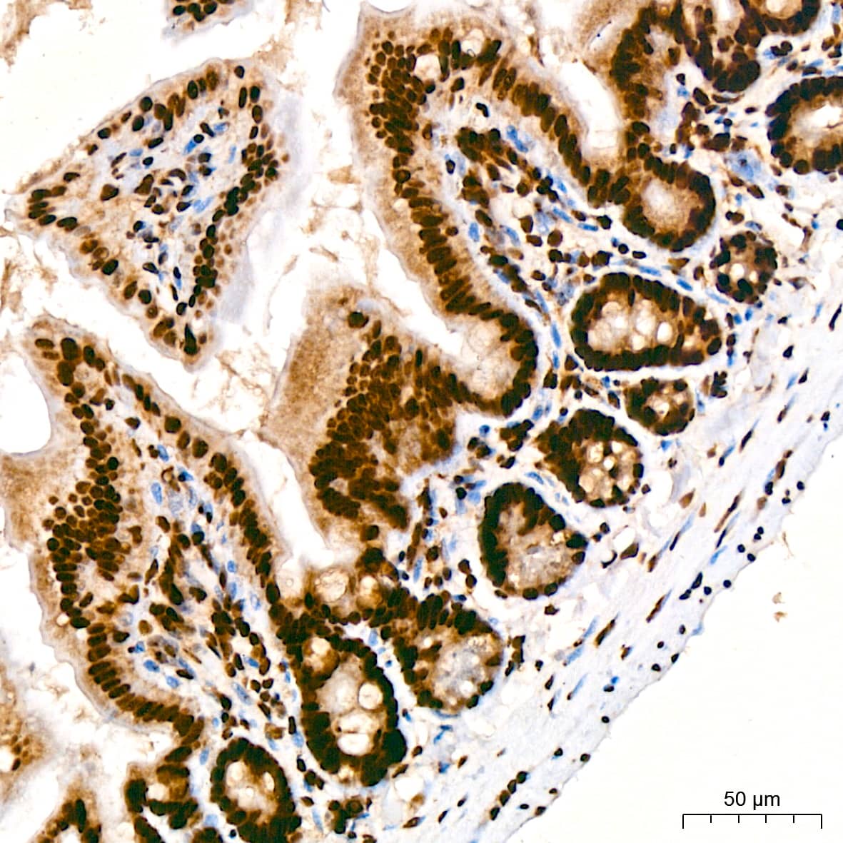 Immunohistochemistry: TDP-43/TARDBP Antibody (4R5L7) [TDP-43/TARDBP] - Immunohistochemistry analysis of paraffin-embedded Mouse colon using TDP-43/TARDBP Rabbit mAb  at dilution of  1:200 (40x lens). High pressure antigen retrieval performed with 0.01M Citrate Bufferr (pH 6.0) prior to IHC staining.