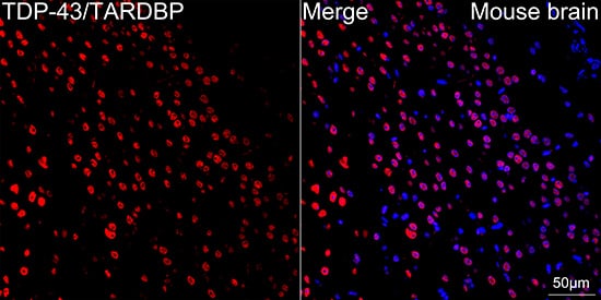 Immunocytochemistry/ Immunofluorescence: TDP-43/TARDBP Antibody (4R5L7) [TDP-43/TARDBP] - Confocal imaging of paraffin-embedded Mouse brain tissue using TDP-43/TARDBP Rabbit mAb   followed by a further incubation with Cy3 Goat Anti-Rabbit IgG (H+L)  . DAPI was used for nuclear staining (Blue). Objective: 40x. Perform microwave antigen retrieval with 0.01 M citrate buffer (pH 6.0) prior to IF staining.