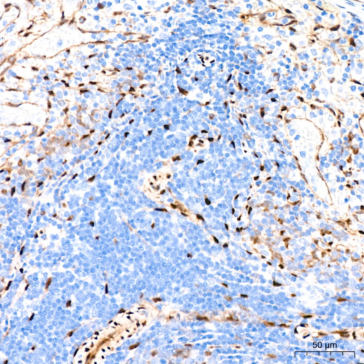 Immunohistochemistry: YAP1 Antibody (10G4S10) [YAP1] - Immunohistochemistry analysis of paraffin-embedded Rat spleen tissue using [KO Validated] YAP1 Rabbit mAb  at a dilution of 1:400 (40x lens). High pressure antigen retrieval performed with 0.01M Citrate Bufferr (pH 6.0) prior to IHC staining.