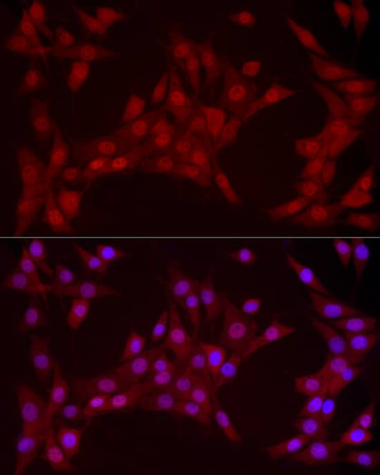 <b>Genetic Strategies Validation. </b>Immunocytochemistry/ Immunofluorescence: YAP1 Antibody (10G4S10) [YAP1] - Immunofluorescence analysis of NIH/3T3 cells using [KO Validated] YAP1 Rabbit mAb  at dilution of  1:100 (40x lens). Secondary antibody: Cy3-conjugated Goat anti-Rabbit IgG (H+L)  at 1:500 dilution. Blue: DAPI for nuclear staining.