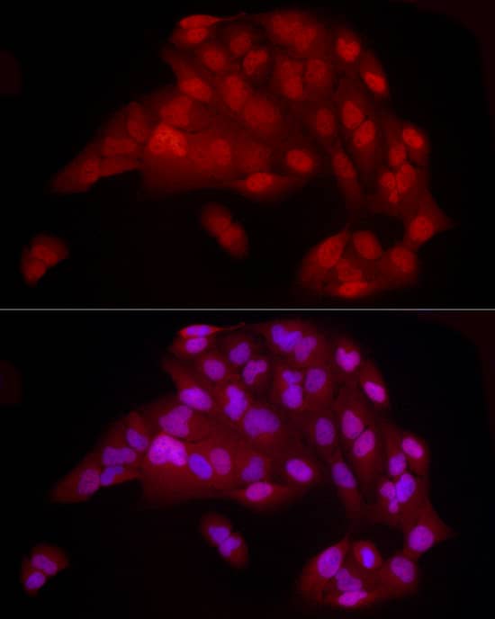 Immunocytochemistry/ Immunofluorescence: YAP1 Antibody (10G4S10) [YAP1] - Immunofluorescence analysis of U20S cells using [KO Validated] YAP1 Rabbit mAb  at dilution of  1:100 (40x lens). Secondary antibody: Cy3-conjugated Goat anti-Rabbit IgG (H+L)  at 1:500 dilution. Blue: DAPI for nuclear staining.