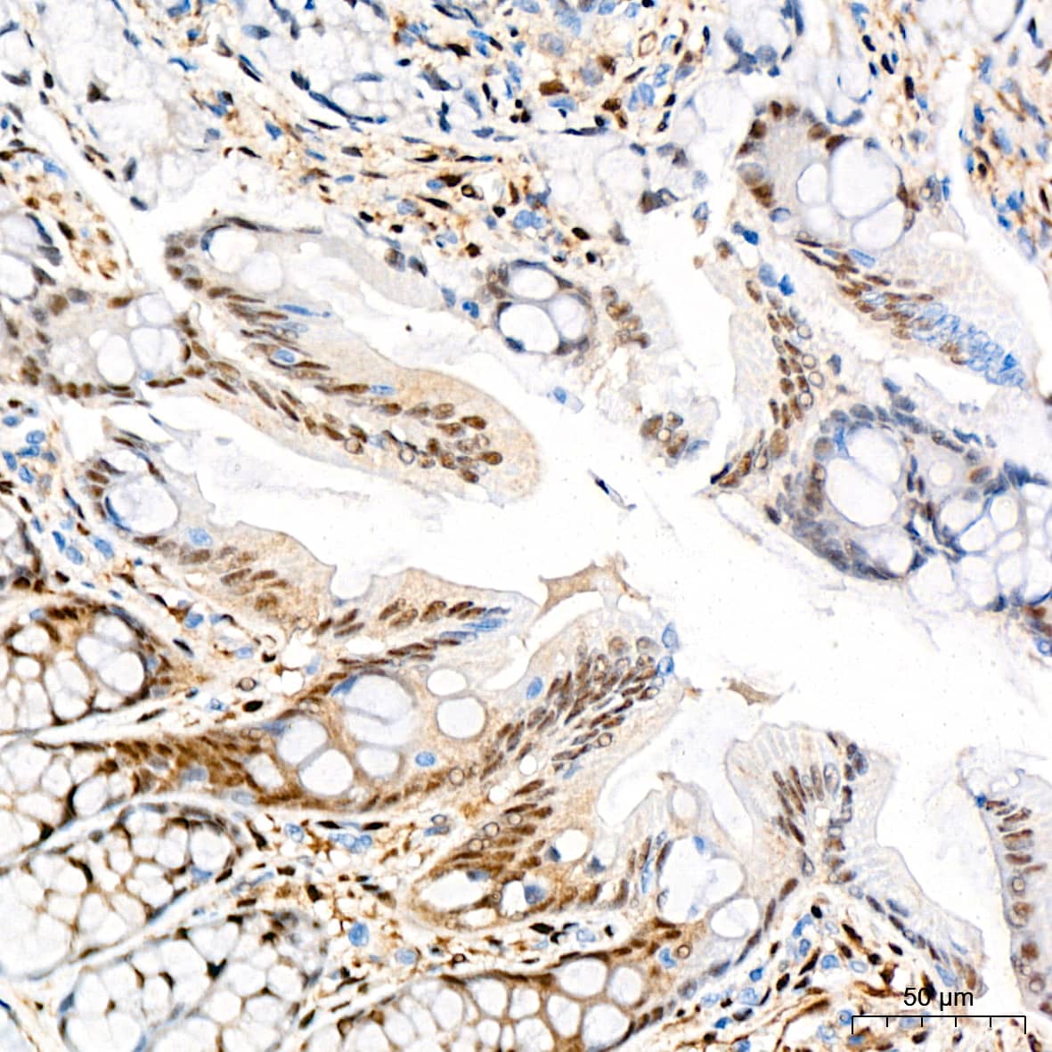 Immunohistochemistry: YAP1 Antibody (10G4S10) [YAP1] - Immunohistochemistry analysis of paraffin-embedded Rat colon tissue using [KO Validated] YAP1 Rabbit mAb  at a dilution of 1:400 (40x lens). High pressure antigen retrieval performed with 0.01M Citrate Bufferr (pH 6.0) prior to IHC staining.