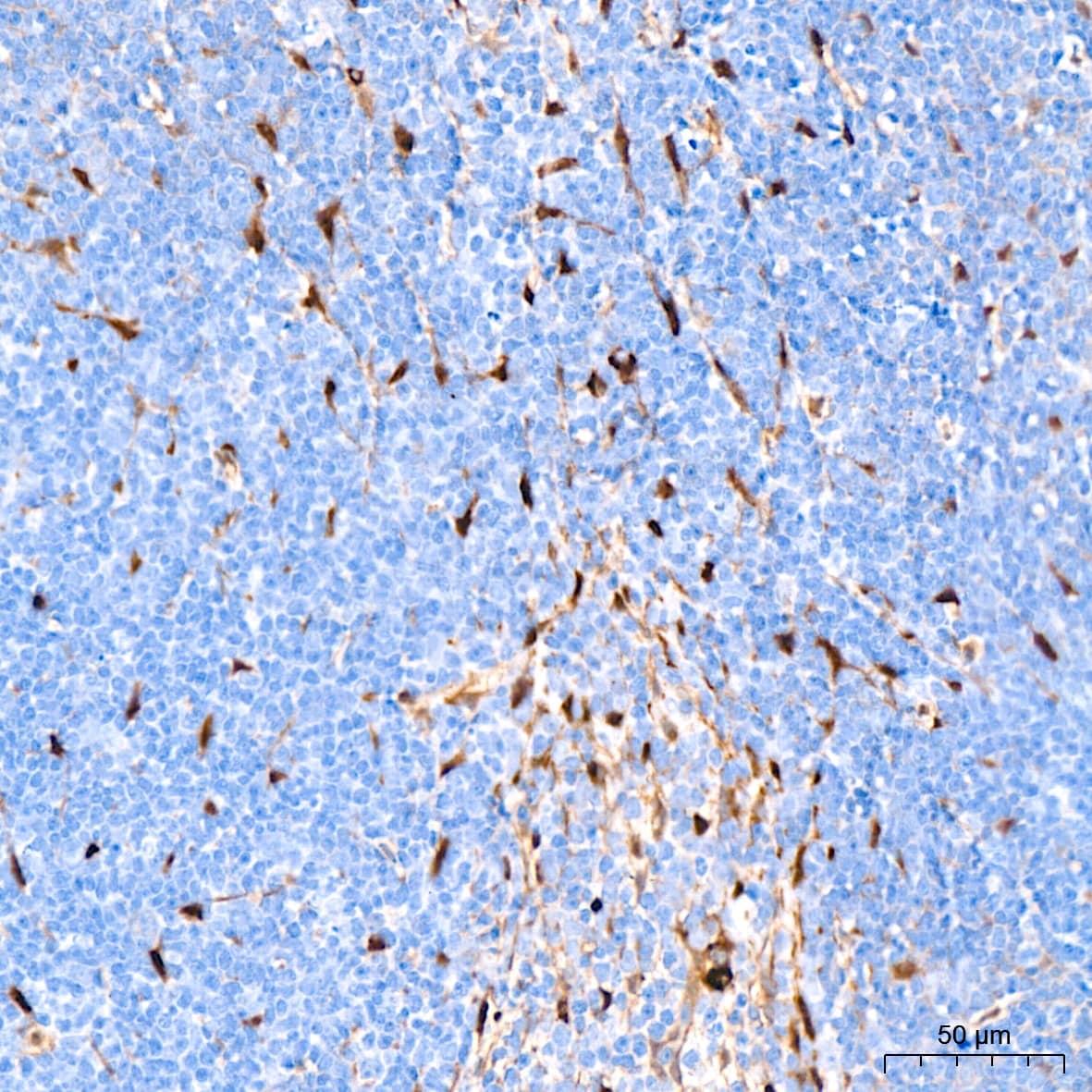 Immunohistochemistry: YAP1 Antibody (10G4S10) [YAP1] - Immunohistochemistry analysis of paraffin-embedded Mouse spleen tissue using [KO Validated] YAP1 Rabbit mAb  at a dilution of 1:400 (40x lens). High pressure antigen retrieval performed with 0.01M Citrate Bufferr (pH 6.0) prior to IHC staining.