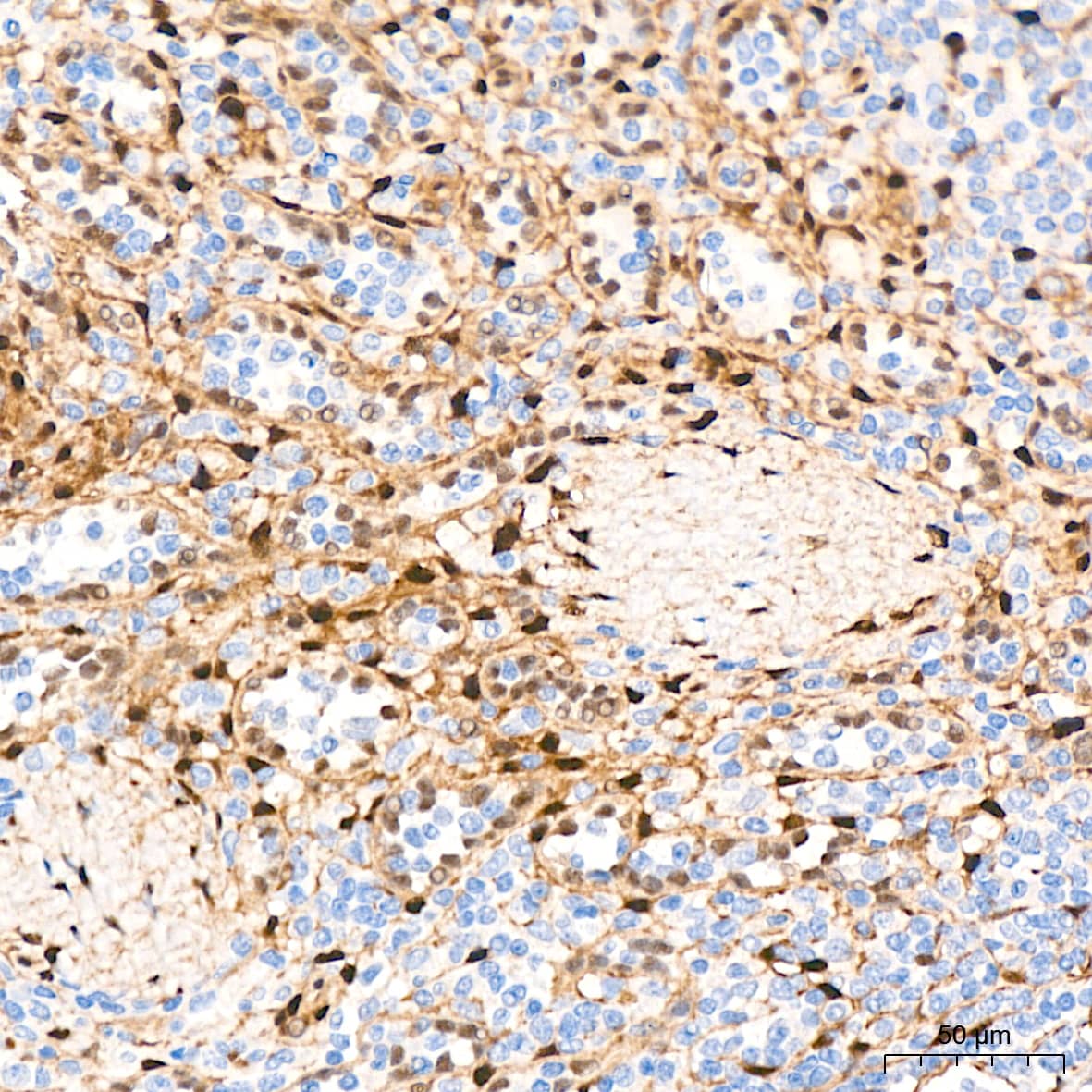 Immunohistochemistry: YAP1 Antibody (10G4S10) [YAP1] - Immunohistochemistry analysis of paraffin-embedded Human spleen tissue using [KO Validated] YAP1 Rabbit mAb  at a dilution of 1:400 (40x lens). High pressure antigen retrieval performed with 0.01M Citrate Bufferr (pH 6.0) prior to IHC staining.