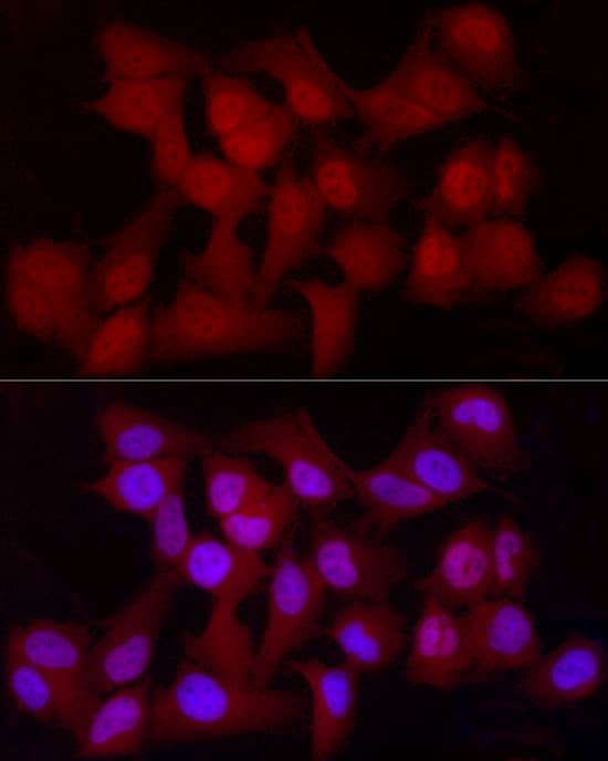 Immunocytochemistry/ Immunofluorescence: YAP1 Antibody (10G4S10) [YAP1] - Immunofluorescence analysis of HeLa cells using [KO Validated] YAP1 Rabbit mAb  at dilution of  1:100 (40x lens). Secondary antibody: Cy3-conjugated Goat anti-Rabbit IgG (H+L)  at 1:500 dilution. Blue: DAPI for nuclear staining.