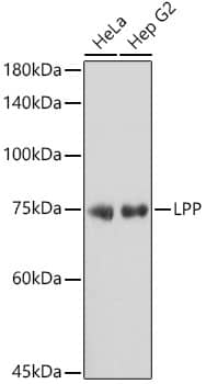 Western Blot: LPP Antibody (8M2R8) [LPP] - Western blot analysis of various lysates using LPP Rabbit mAb  at 1:1000 dilution.Secondary antibody: HRP Goat Anti-Rabbit IgG (H+L)  at 1:10000 dilution.Lysates/proteins: 25ug per lane.Blocking buffer: 3% nonfat dry milk in TBST.Detection: ECL Basic Kit .Exposure time: 5s.