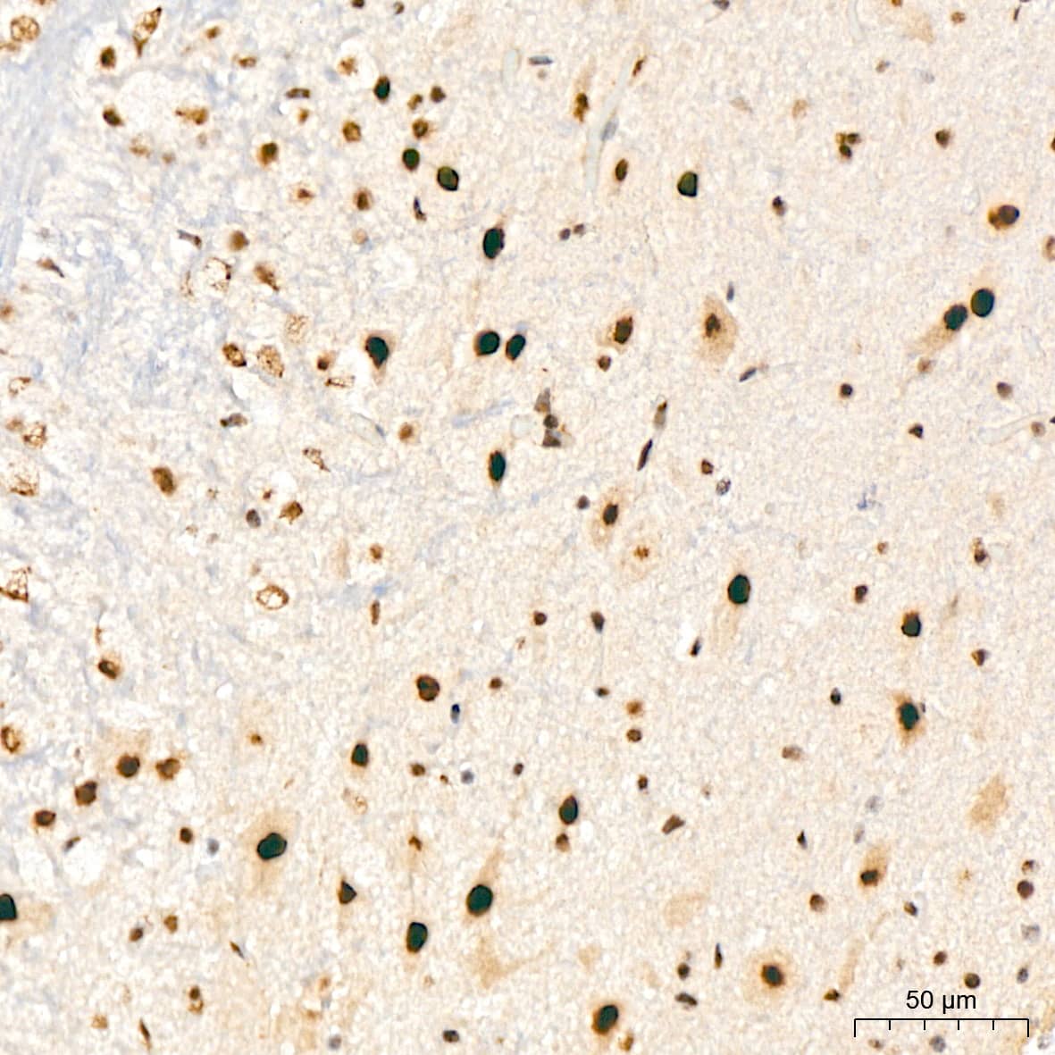 Immunohistochemistry XPD Antibody (6T9K6)