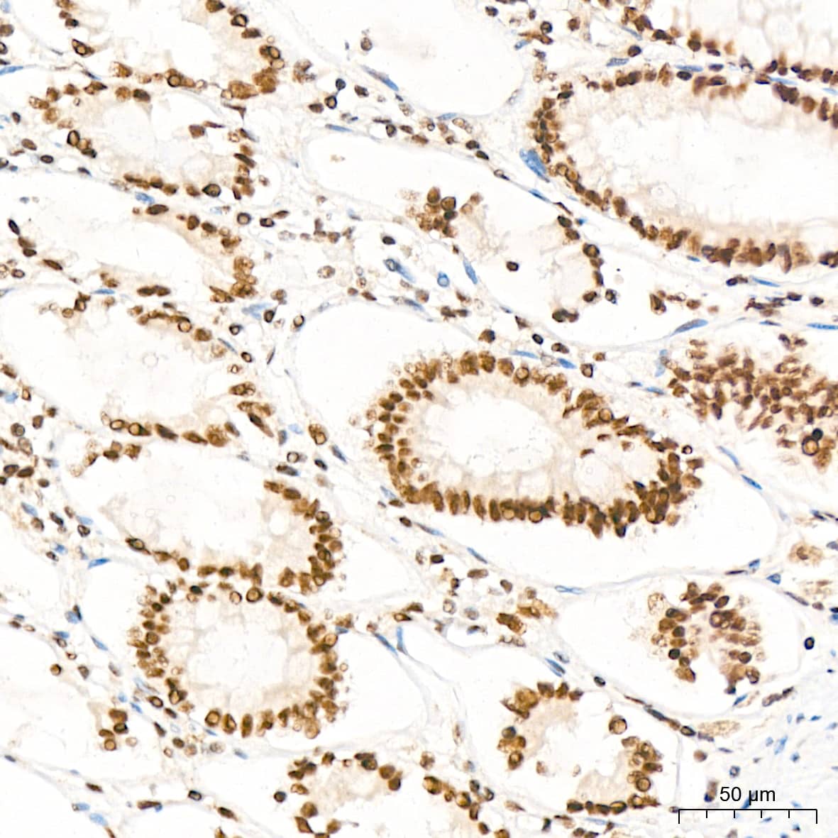 Immunohistochemistry: XPD Antibody (6T9K6) [NBP3-15704] - Immunohistochemistry analysis of XPD in paraffin-embedded human colon tissue using XPD Rabbit mAb  at a dilution of 1:200 (40x lens). High pressure antigen retrieval was performed with 0.01 M Tris-EDTA buffer (pH 9.0) prior to IHC staining.