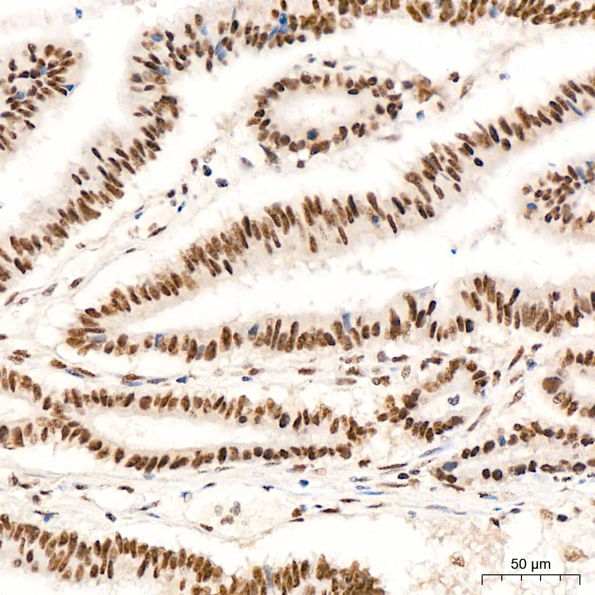 Immunohistochemistry XPD Antibody (6T9K6)