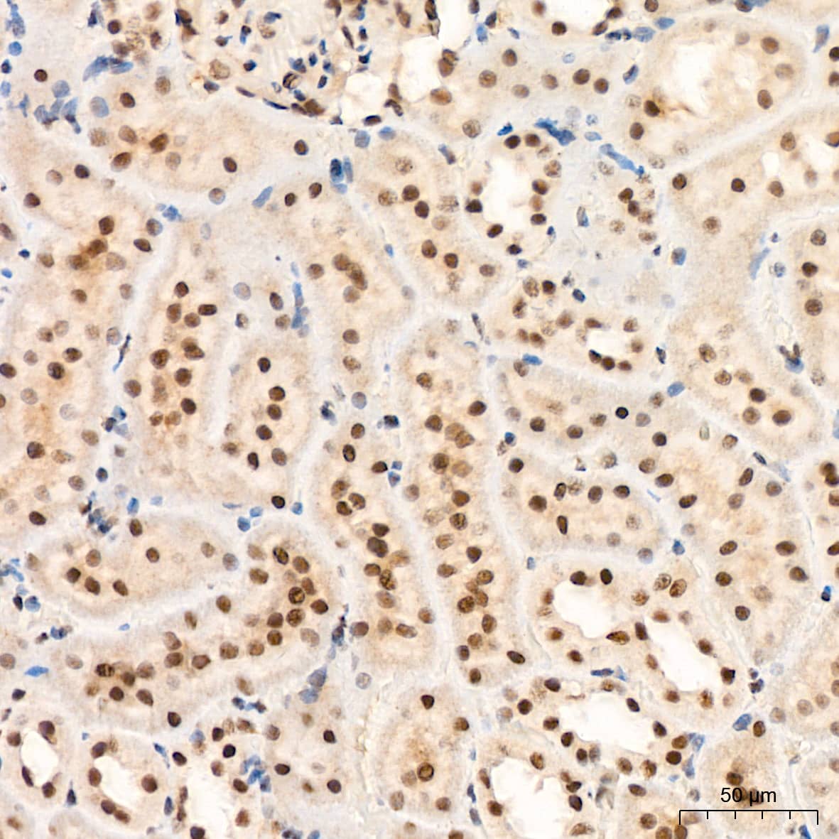 Immunohistochemistry: XPD Antibody (6T9K6) [NBP3-15704] - Immunohistochemistry analysis of XPD in paraffin-embedded rat kidney tissue using XPD Rabbit mAb  at a dilution of 1:200 (40x lens). High pressure antigen retrieval was performed with 0.01 M Tris-EDTA buffer (pH 9.0) prior to IHC staining.