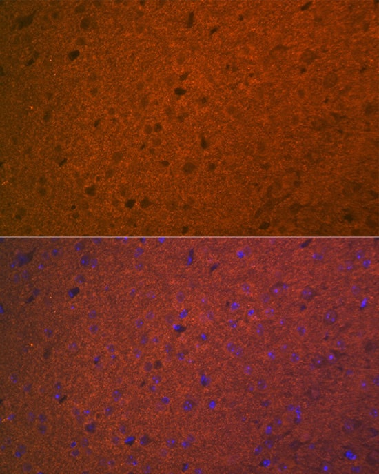 Immunocytochemistry/ Immunofluorescence: Syntaxin 1A Antibody (2B2F10) [Syntaxin 1A] - Immunofluorescence analysis of paraffin-embedded mouse brain using Syntaxin 1A Rabbit mAb  at dilution of 1:100 (40x lens). Secondary antibody: Cy3 Goat Anti-Rabbit IgG (H+L)  at 1:500 dilution. Blue: DAPI for nuclear staining.