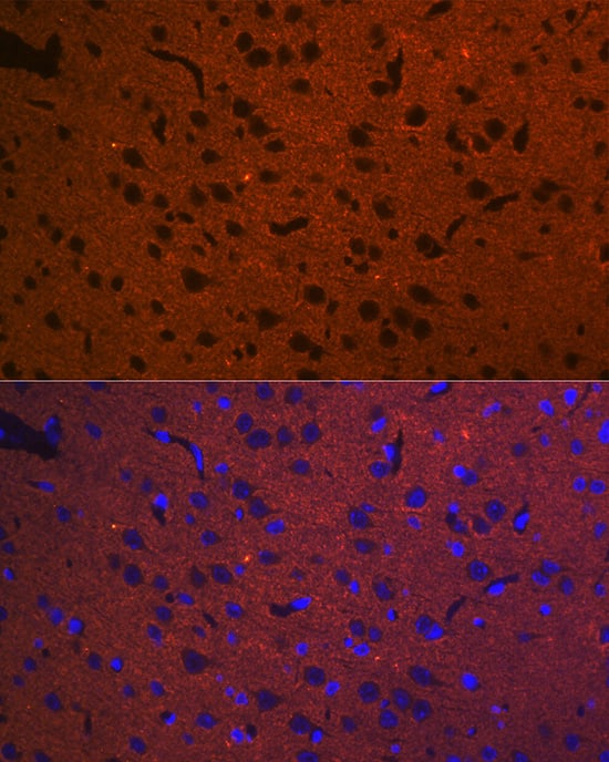 Immunocytochemistry/ Immunofluorescence: Syntaxin 1A Antibody (2B2F10) [Syntaxin 1A] - Immunofluorescence analysis of paraffin-embedded rat brain using Syntaxin 1A Rabbit mAb  at dilution of 1:100 (40x lens). Secondary antibody: Cy3 Goat Anti-Rabbit IgG (H+L)  at 1:500 dilution. Blue: DAPI for nuclear staining.