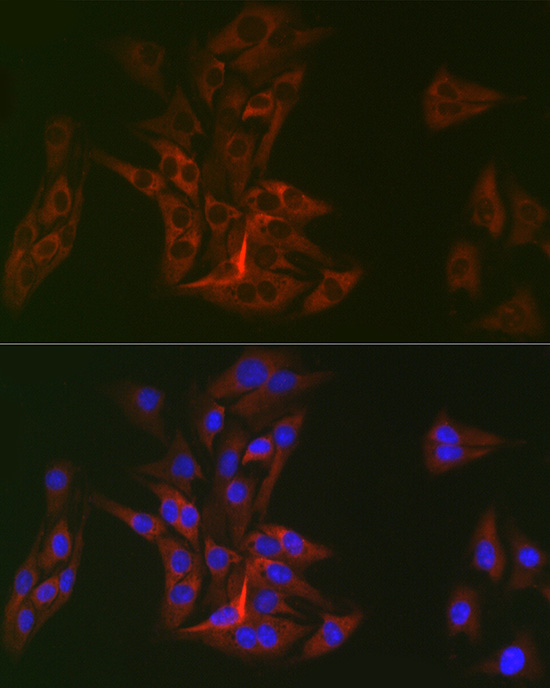 Immunocytochemistry/ Immunofluorescence DOK1 Antibody (6U4U9)