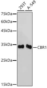 Western Blot: CBR1 Antibody (3A9O5) [CBR1] - Western blot analysis of various lysates using CBR1 Rabbit mAb  at 1:1000 dilution.Secondary antibody: HRP Goat Anti-Rabbit IgG (H+L)  at 1:10000 dilution.Lysates/proteins: 25ug per lane.Blocking buffer: 3% nonfat dry milk in TBST.Detection: ECL Basic Kit .Exposure time: 10s.