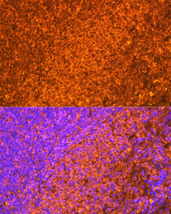 Immunocytochemistry/ Immunofluorescence: EBI3 Antibody (9J1H4) [EBI3] - Immunofluorescence analysis of paraffin-embedded rat spleen using EBI3 Rabbit mAb  at dilution of 1:100 (40x lens). Secondary antibody: Cy3-conjugated Goat anti-Rabbit IgG (H+L)  at 1:500 dilution. Blue: DAPI for nuclear staining.